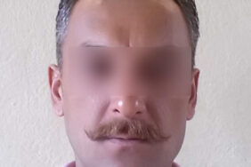 mide_bulandiran_olay