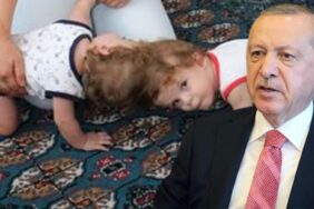 mahmutlar_yapisik_ikizler_ayrildi_